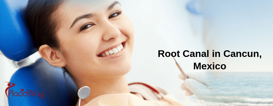 Root Canal in Cancun, Mexico